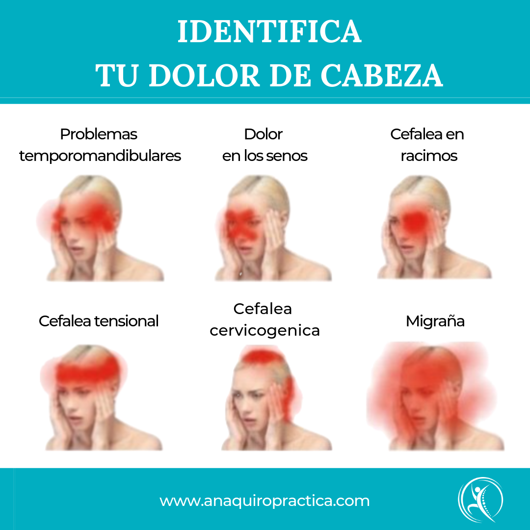 Tipos de dolores de cabeza fisiomibe majadahonda