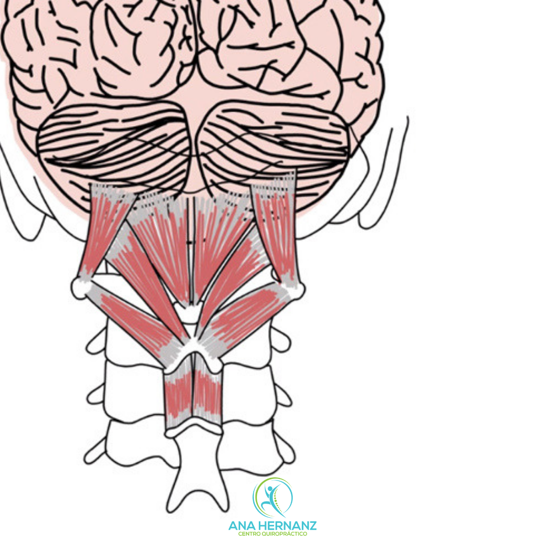 Cefalea cervical: Las cefaleas causadas por dolor cervical